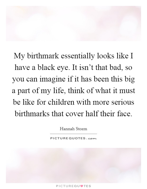 My birthmark essentially looks like I have a black eye. It isn't that bad, so you can imagine if it has been this big a part of my life, think of what it must be like for children with more serious birthmarks that cover half their face. Picture Quote #1