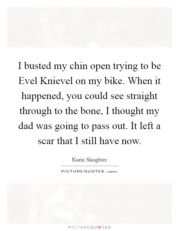 I busted my chin open trying to be Evel Knievel on my bike. When it happened, you could see straight through to the bone, I thought my dad was going to pass out. It left a scar that I still have now. Picture Quote #1