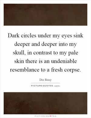 Dark circles under my eyes sink deeper and deeper into my skull, in contrast to my pale skin there is an undeniable resemblance to a fresh corpse Picture Quote #1
