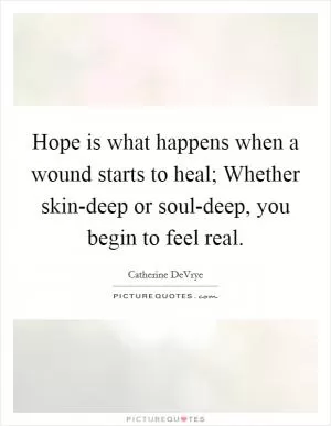 Hope is what happens when a wound starts to heal; Whether skin-deep or soul-deep, you begin to feel real Picture Quote #1
