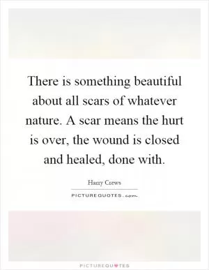 There is something beautiful about all scars of whatever nature. A scar means the hurt is over, the wound is closed and healed, done with Picture Quote #1